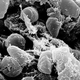 Image for article titled One Of The Ways The Bubonic Plague Kills You Is By Stealing Your Iron